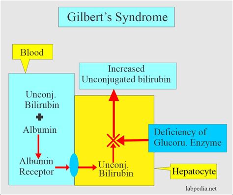 gilbert syndrome bilirubin level